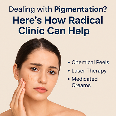 Dealing with Pigmentation